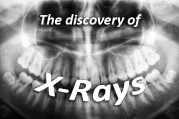 Puyallup dentist, Dr. Roland Vantramp at Dove Family Dentistry discusses the discovery of x-rays and how they have advanced over the years.